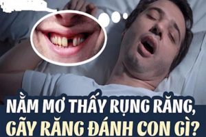 Mơ thấy rụng răng đánh số mấy? Và điềm báo hên hay xui