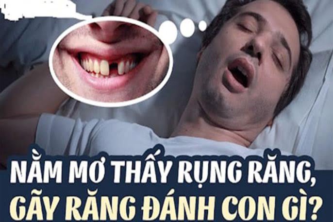 Mơ thấy rụng răng đánh số mấy? Và điềm báo hên hay xui