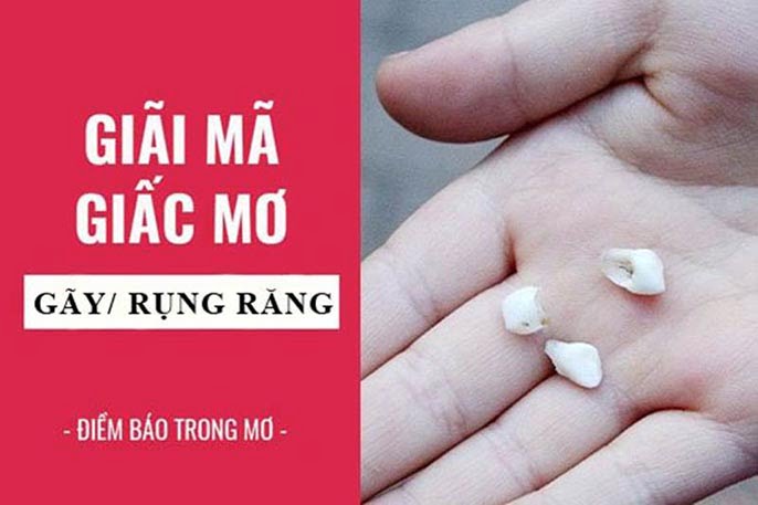 Mơ thấy rụng răng đánh số mấy? Và điềm báo hên hay xui